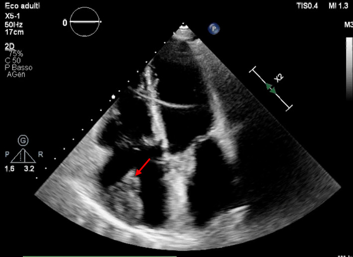 FIGURE 1