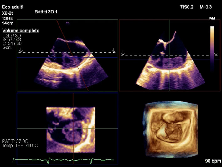 FIGURE 3