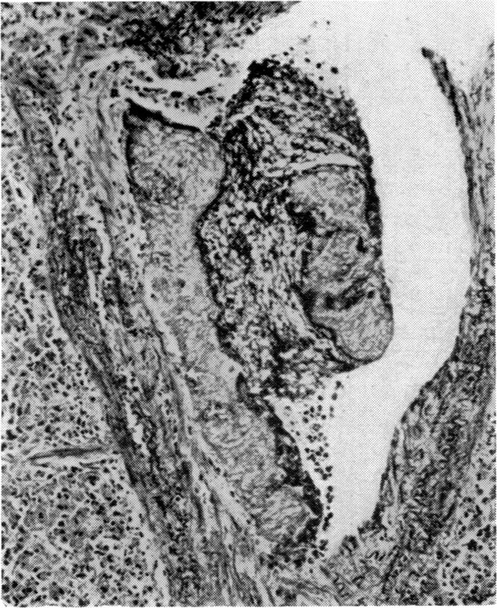 FIG. 8