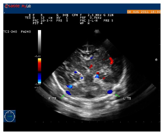 Figure 4