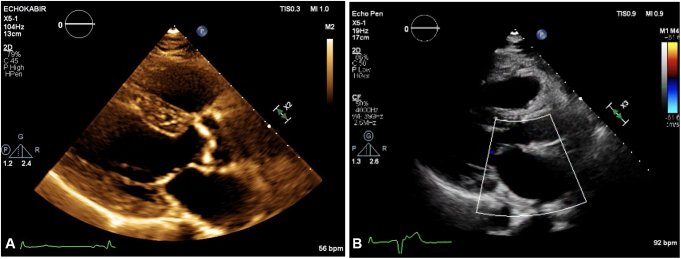 Figure 1