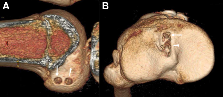 Fig 12