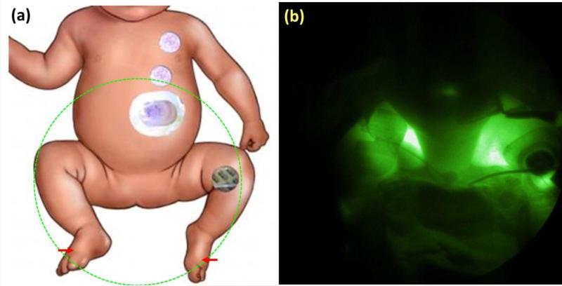 Fig. 2