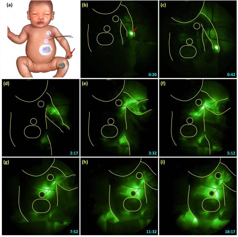 Fig. 3