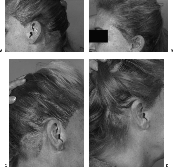 Figure 17