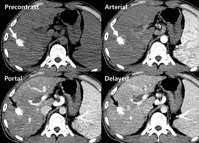 Figure 9a: