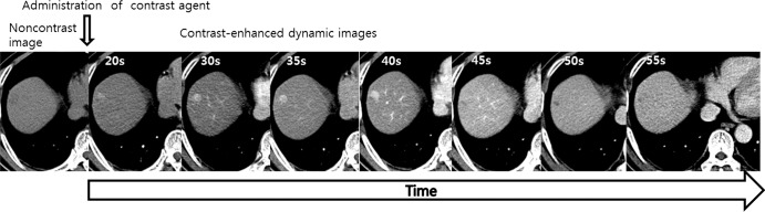 Figure 1: