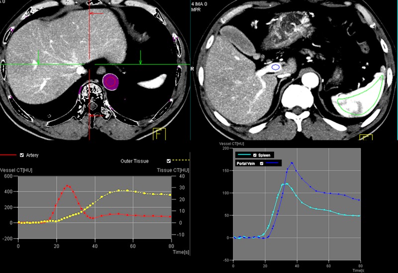 Figure 2a: