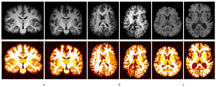 Fig. 11