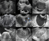 Fig. 2