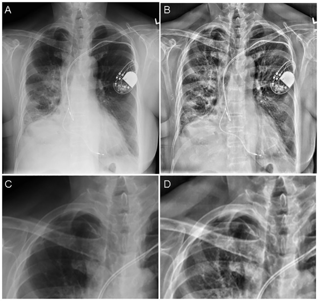 Fig 1