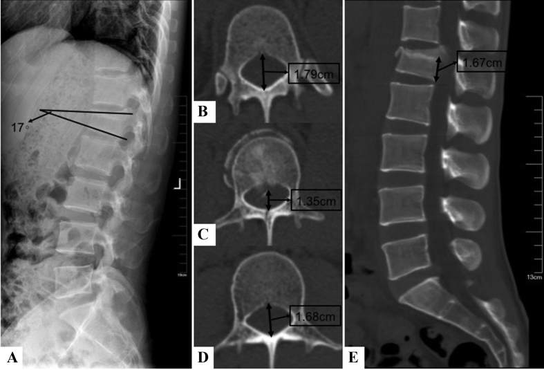 Figure 4