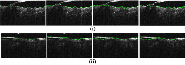 Fig. 11