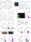 Figure 1. Chemotherapy correlates with CTC cluster formation and loss of α2,6-SA/ST6GAL1. A, The probability of OS by Kaplan–Meier estimates in the patients with advanced-stage breast cancer, stratified by three alteration patterns of single CTCs (left) or CTC clusters (middle) between baseline (prior to treatment) and the first radiologic evaluation (E1) after 3-month treatment, including (i) decreased CTCs; (ii) stably low or negative CTCs; and (iii) increased or stably high CTCs (singles or clusters). Wilcoxon signed-rank test P < 0.0001. CTCs were detected via CellSearch. Right, representative CellSearch images of a single CTC (CK+DAPI+CD45−) at baseline (top row) and a two-cell CTC cluster at E1 (bottom) from a chemo-treated patient (scale bars = 10 μm). Dec, decreased; Inc, increased; Neg, negative. B, Dynamic counts of CellSearch-detected CTCs (# events), singles and CTC clusters, at baseline and E1 for each breast cancer patient treated with chemotherapy (blue lines) and nonchemotherapy options (purple lines). Wilcoxon signed rank test for CTC cluster alterations P = 0.0158 with chemo (n = 47) and P = 0.6447 without chemo (n = 35); for single CTC alterations P = 0.5461 with chemo and P = 0.5028 without chemo. C, The probability of OS by Kaplan–Meier estimates in patients with advanced-stage breast cancer with or without chemotherapy (chemo ±, left and right), stratified by the CTC alteration patterns of decreased, negative or stable low, and increased CTC cluster events at E1 compared with baseline (log-rank test P = 0.0071 and P < 0.0001). CTCs were measured by CellSearch. D, Representative images (left) and quantification (right) of Sambucus Nigra (SNA)–bound α2,6-SA signals in individual CTCs, both singles (S; n = 120 cells) and from clusters [C; n = 44 tumor cells in the clusters (homotypic and heterotypic clusters of CTCs and CD45+ cells)] of patients with breast cancer (n = 6 patients), analyzed by CellSearch (scale bars = 10 μm). E, The bar graphs of SNA-high populations within singles (S) and clusters (C) in nonchemo-treated patients (left: −Chemo), chemo-treated patients (middle: +Chemo, n = 46, P = 0.002), and paclitaxel-treated patients (right: +PAX, n = 6, P = 0.038). F, Schematic of the PAX treatment for PDX-M1 tumors and subsequent analyses of CTCs and lung metastases (mets). One week after orthotopic implantation of PDX-M1 tumor cells into mouse mammary fat pads, mice were treated with PBS or PAX-NAB (PAX; 13.5 mg/kg) once every 3 days via tail vein 10 times. Three days after the last treatment, mice were sacrificed with collections of blood, breast tumors, and lungs for analyses of CTCs, tumors, and metastasis burdens, respectively. G–N, After PBS/PAX treatments shown in F, representative photos of PDX tumors (G; scale bars = 1 cm) and quantification of the tumor weight (H), bioluminescence images of dissected lungs ex vivo (I) and quantified lung metastases in total flux (J), counts of single CTCs (K) and CTC clusters (L) in PBS- and PAX-treated mice, and the percentage of SNA-high CTCs in singles vs. clusters in mice treated with PBS (M) and PAX (N). CTCs were analyzed via flow cytometry. P values were calculated by GraphPad (Student t test) unless otherwise indicated. Data, mean ± SD.