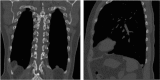 Fig. 1a and Fig. 1b