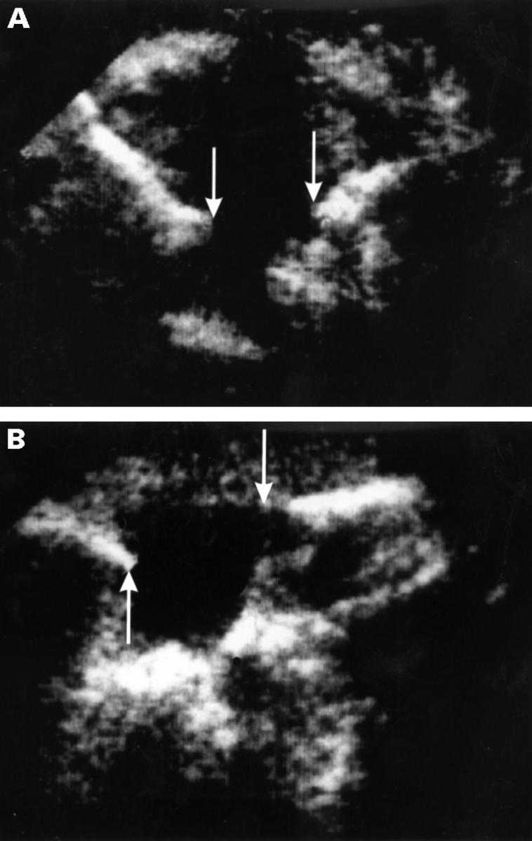 Figure 3  