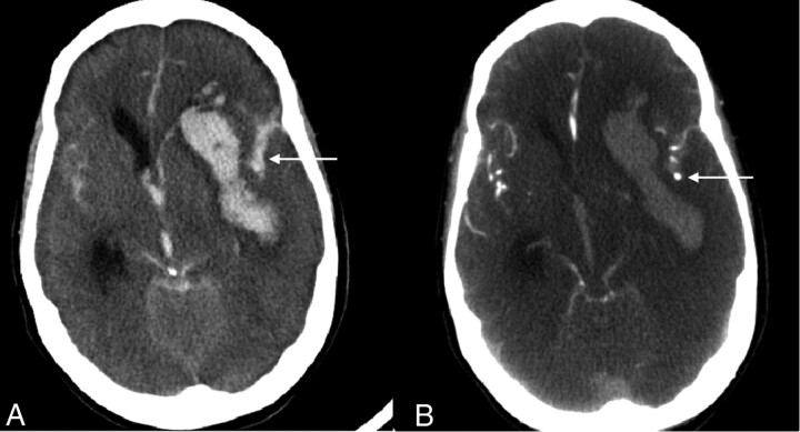 Fig 3.