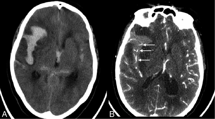 Fig 2.