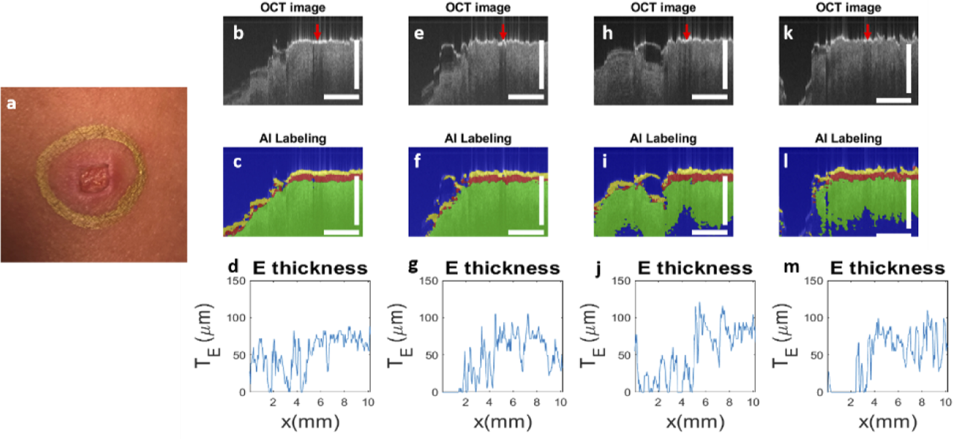 Fig. 11.