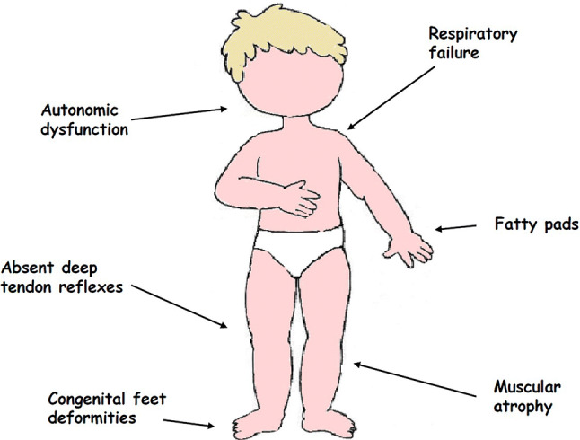 Fig. 1