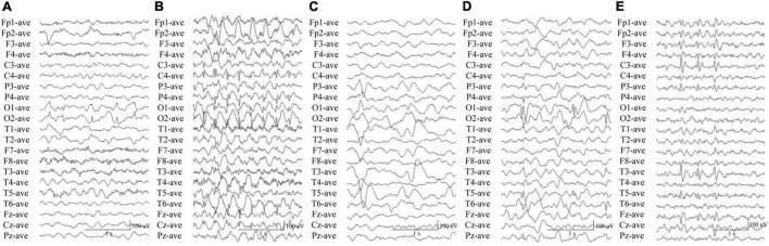 FIGURE 3