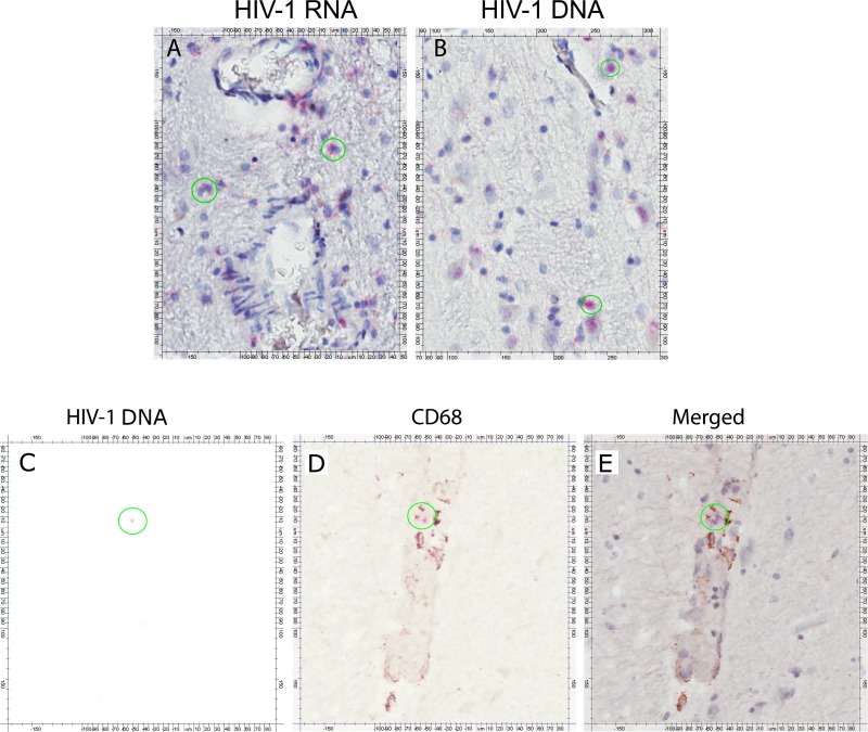 Fig 4