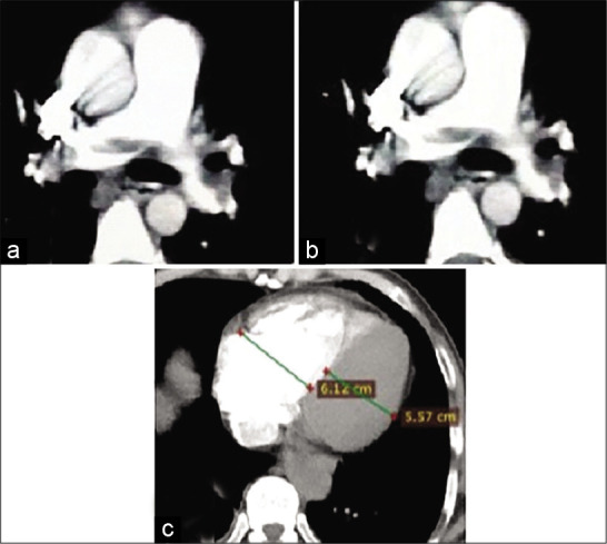 Figure 4: