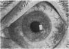 332