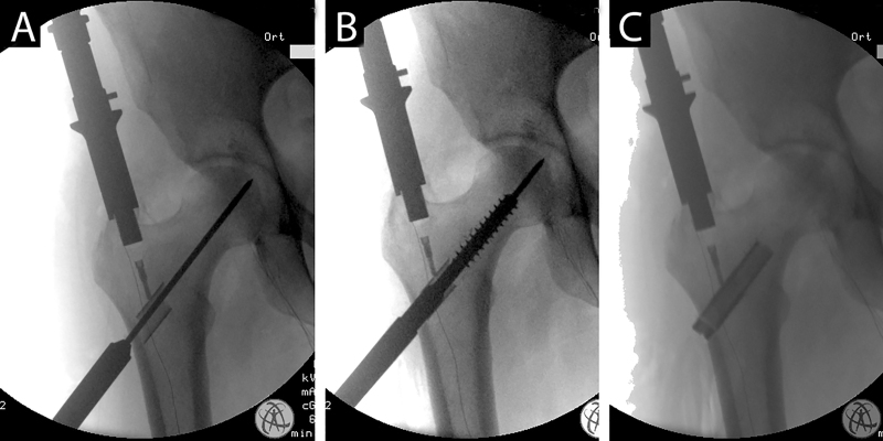 Fig. 2