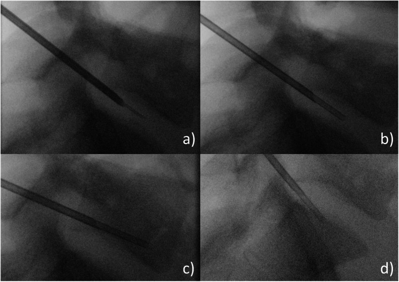 Fig. 1