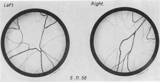 Figs. 4-8