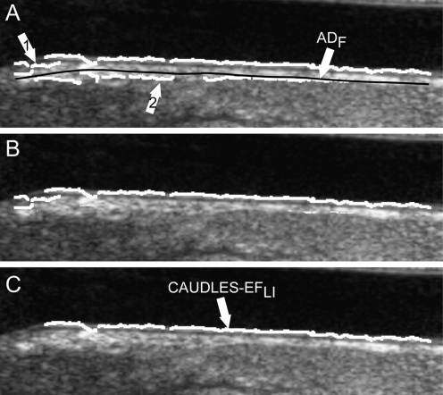 Fig. 12