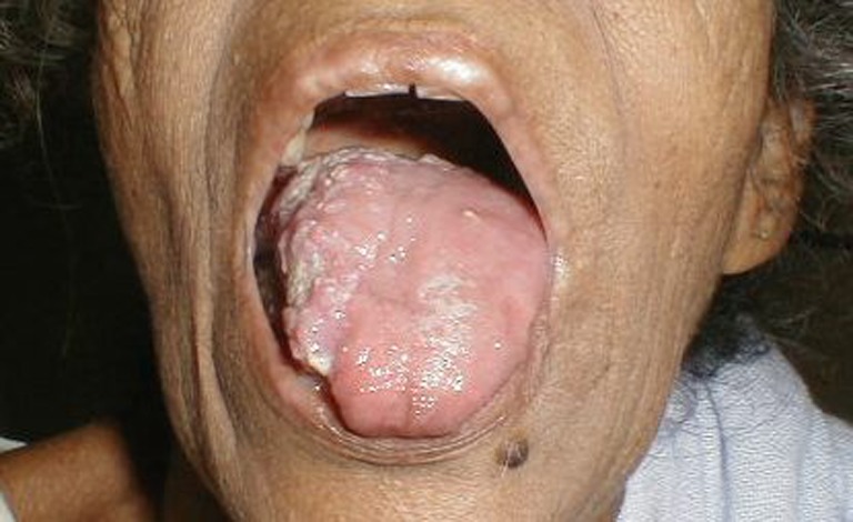 Fig.
                            1