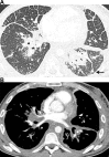 Figure 11.