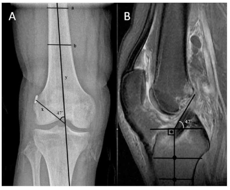 Fig. (2)