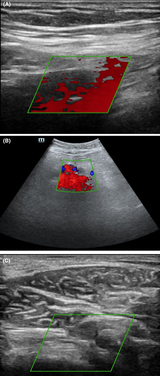 FIGURE 3