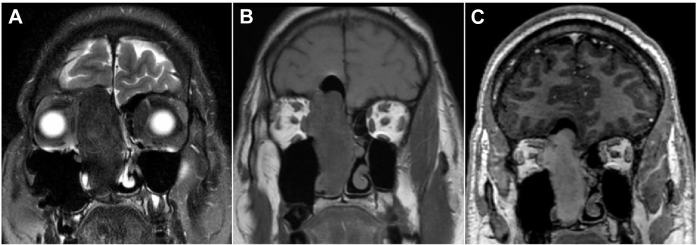 Fig. 3