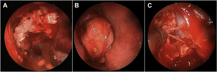 Fig. 4