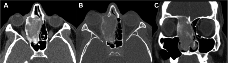 Fig. 1