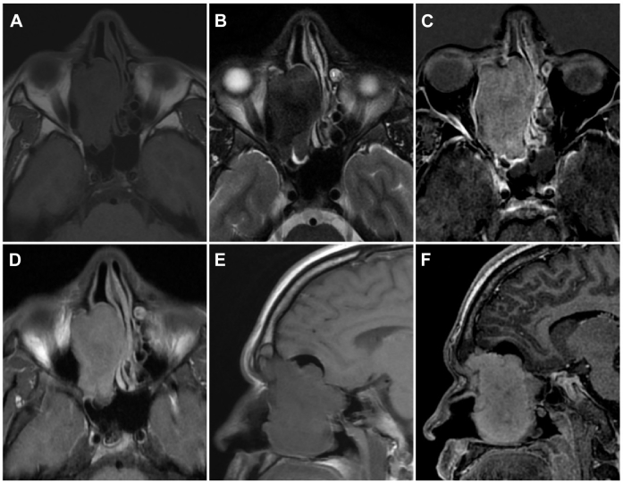 Fig. 2