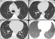 Figure 11.