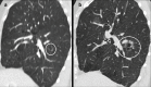 Figure 12.