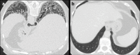 Figure 10.
