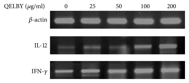 Figure 12