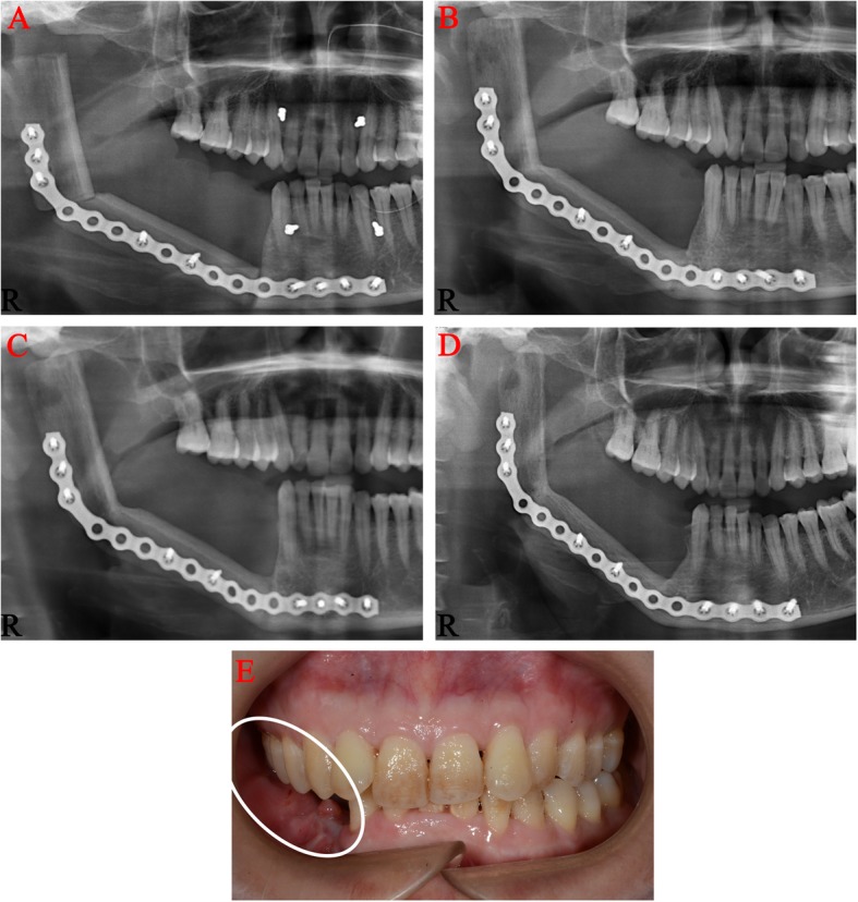 Fig. 5