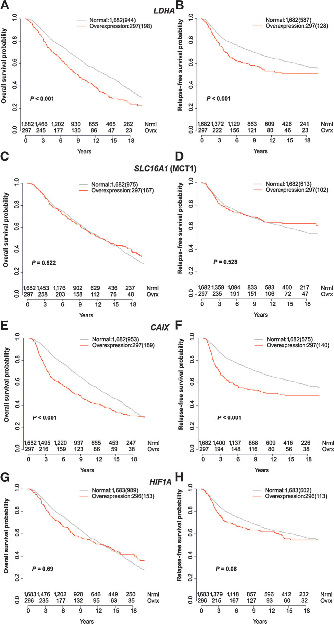 Figure 6. Correlation of LDHA, SLC16A1 (MCT1), CAIX, and HIF1A expression with survival in METABRIC. Kaplan–Meier curves for normal expression and overexpression (85th percentile) of LDHA (A and B), SLC16A1 (MCT) (C and D), HIF1A (E and F), and CAIX (G and H). The left column shows overall survival and the right column relapse-free survival. Number of events are shown in brackets.