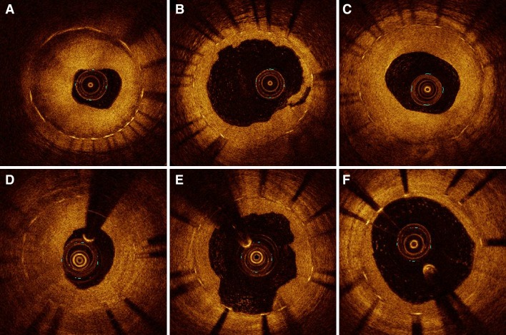 Fig. 1