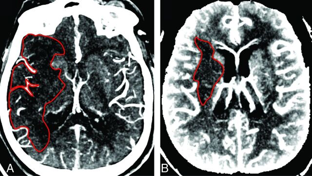 Fig 2.