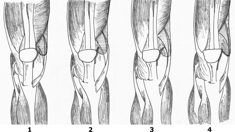 Fig. 2