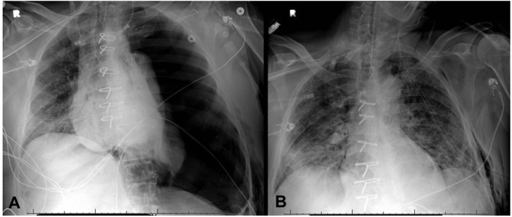 Figure 2